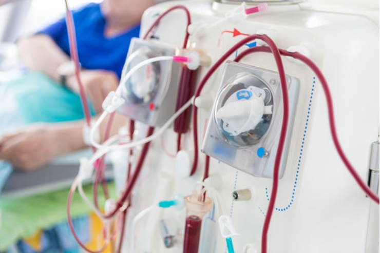 Dialysis------23