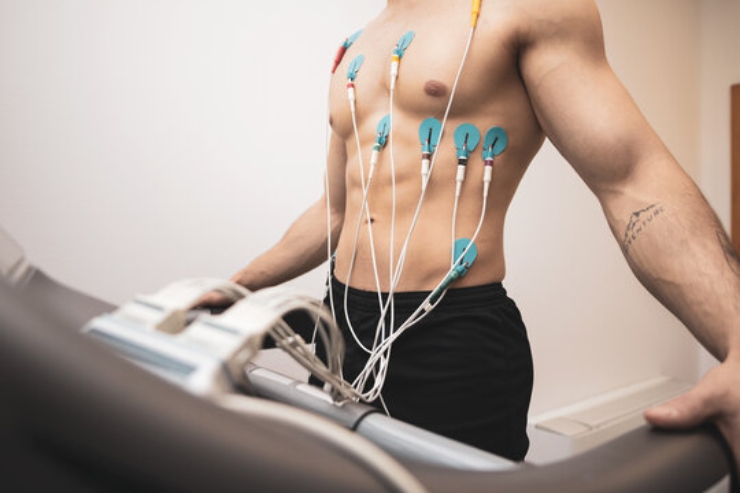ECG------23