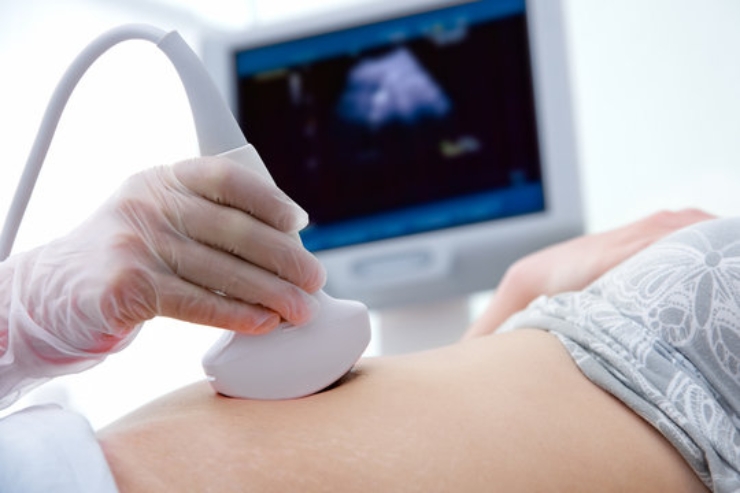 Ultrasound-----23